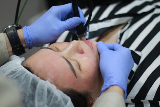 Miracle Clinic Luncurkan Solusi Hiperpigmentasi Kulit Terkini