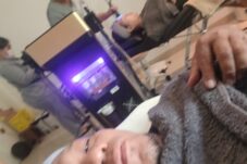 Tren Nose Threadlift, Mancungin Hidung Tanpa Operasi