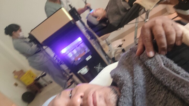 Tren Nose Threadlift, Mancungin Hidung Tanpa Operasi