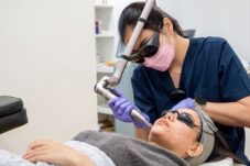 Pico Laser Jadi Tren Perawatan Kulit di Klinik Estetika, Solusi Cerah dan Anti-Aging Sekaligus